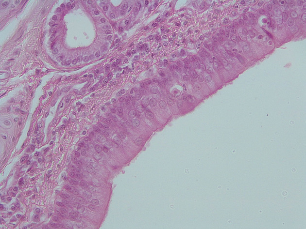 Trachea Slides - Trachea 08 400X
